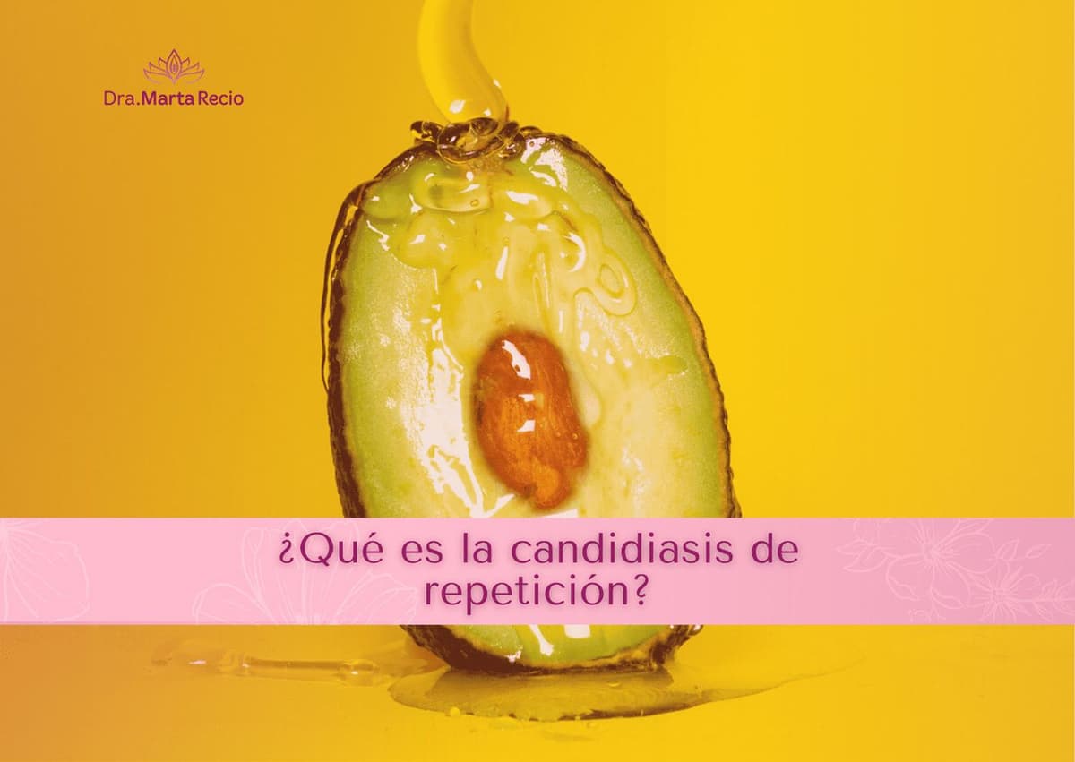 Ilustracion de la candidiasis de repetición